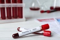 Hepatologist Columbia