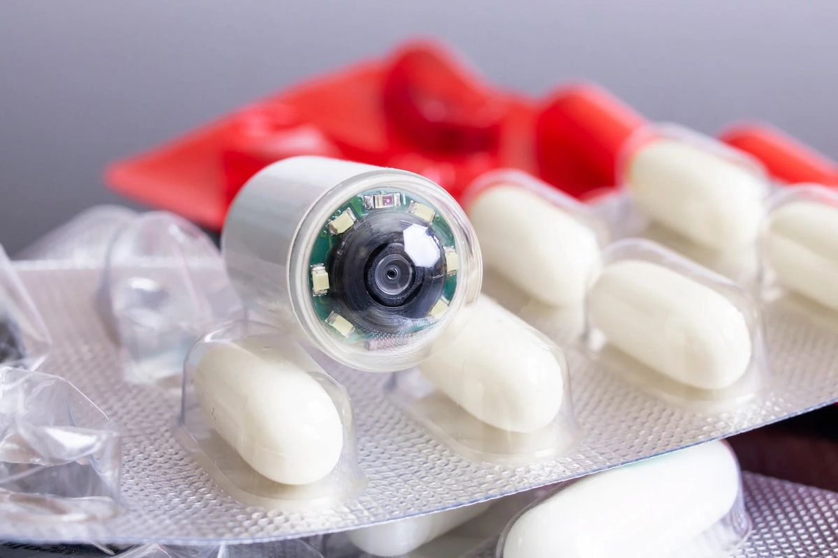 Small Bowel PillCam Endoscopy